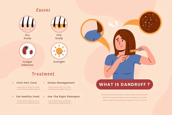 Best Home Remedies For Dandruff